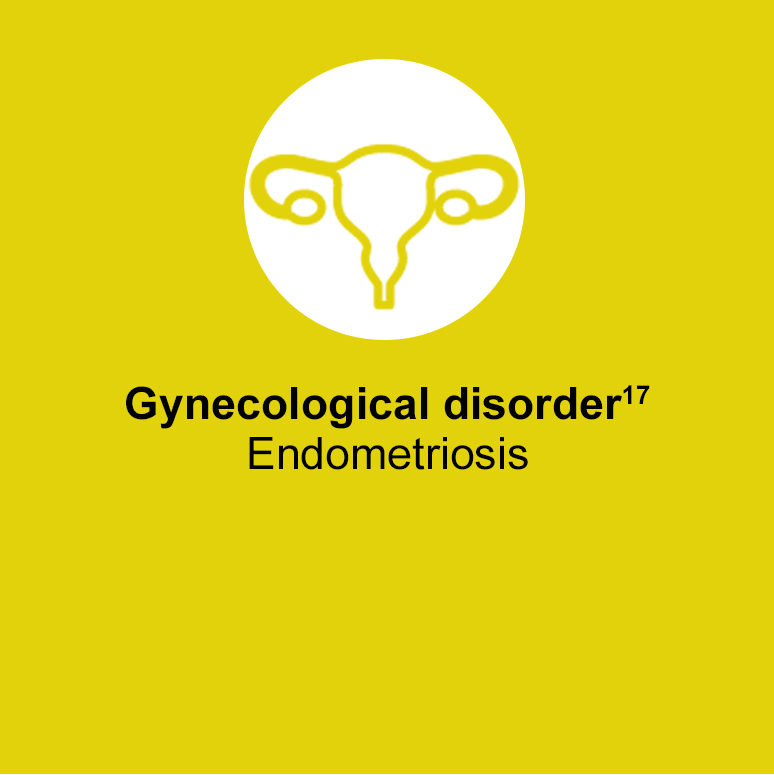 Acute hepatic porphyria can show similar symptoms to gynecological disorders such as endometriosis